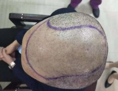 草莓视频污版在线免费观看草莓免费视频软件污下载效果恢复案例