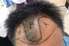 M角效果恢复案例