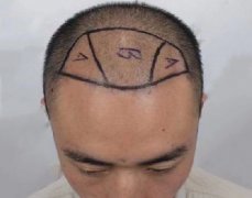 前额草莓免费视频软件污下载案例