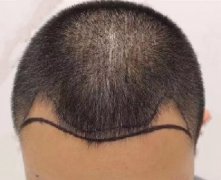M角草莓免费视频软件污下载案例